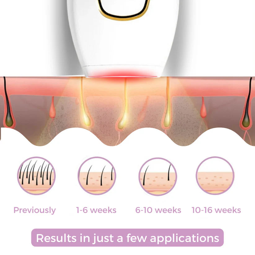 ✨ IPL Laser Hair Removal Device – Permanent, Painless, At-Home Hair Removal for Women & Men | 5 Adjustable Energy Levels | 500,000 Flashes | Face, Legs, Bikini & Body